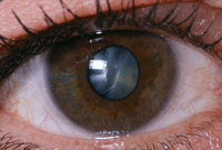 eye